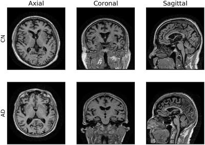 Deep learning-based Alzheimer's disease detection: reproducibility and the effect of modeling choices